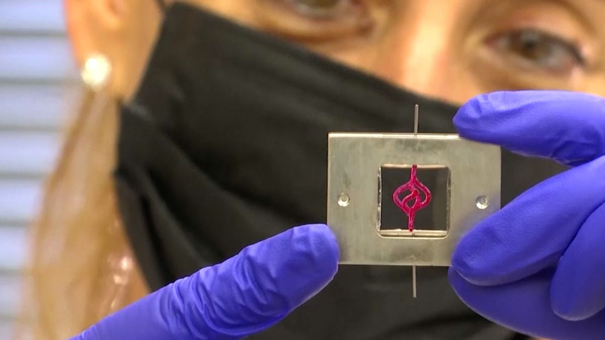 Izraelci vyrábí živé 3D nádory mozku. Urychlí prý léčbu i vývoj nových léků